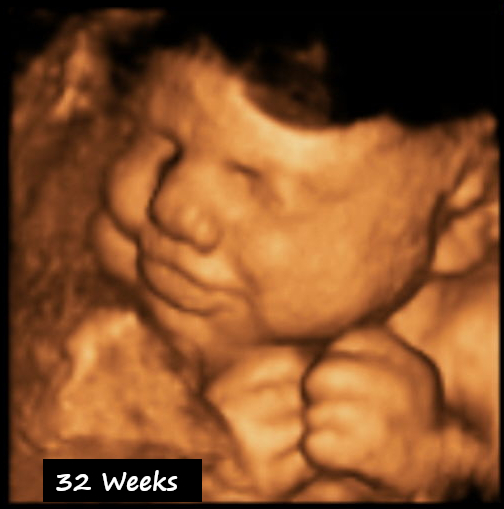 3D Ultrasound In Visalia 